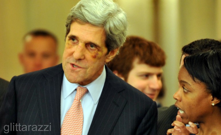 john-kerry-black-eye-2012-01-24-B
