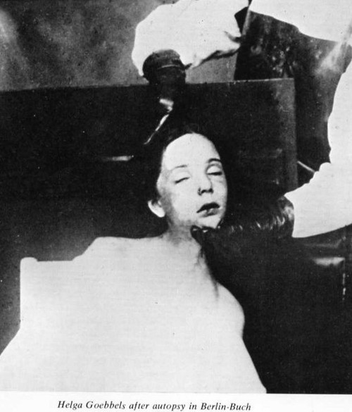 At The End Of The War The Gabbles' Children Were Euthanized.